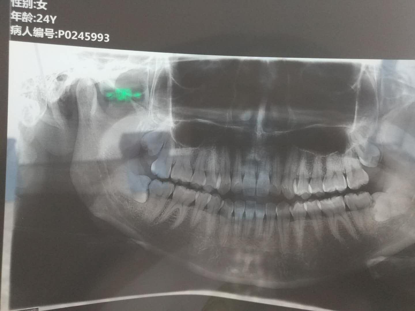 南京口腔医院拔牙一般多少钱,南京口腔医院拔牙费用深度解析与数据应用策略探讨,适用解析计划方案_桌面款37.89.85