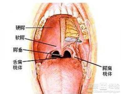 咽炎扁桃体发炎最快治愈法