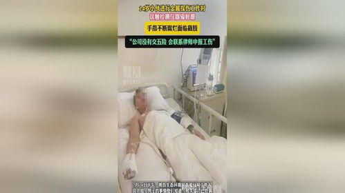 辐射源